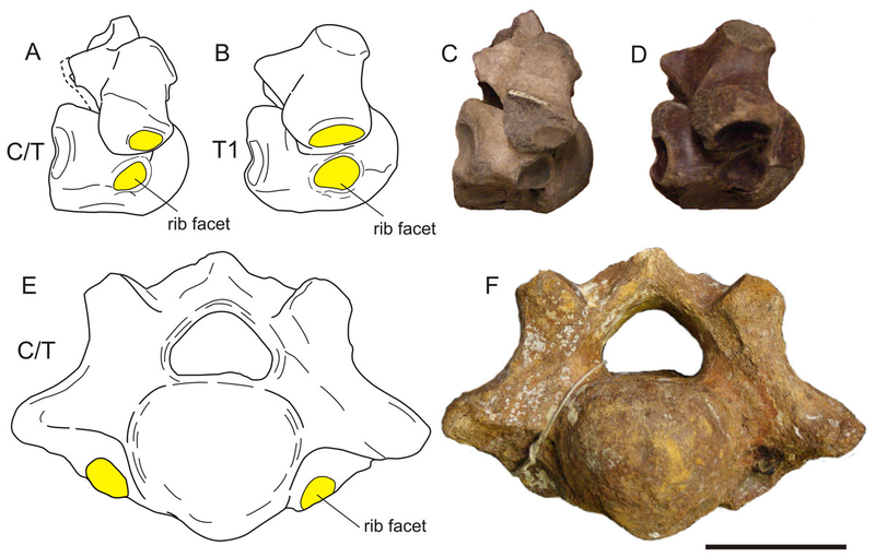 A and C show a deformed cervical vertebra, compared to B and D, a regular vertebra. E and F show another view of the cervical vertebra. (Image: Van der Geer and Gallis, PeerJ (2017))